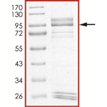 EGFR (d746-750 T790M C797S), Active